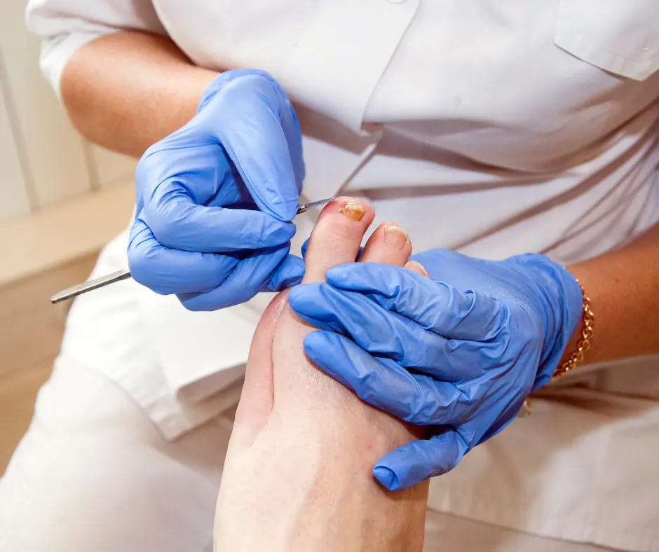 Diabetic Foot Care Treatment Clinic in Bareilly