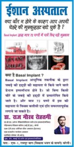 basal implant