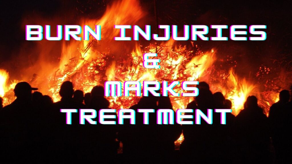 Burn Injuries & Marks Treatment