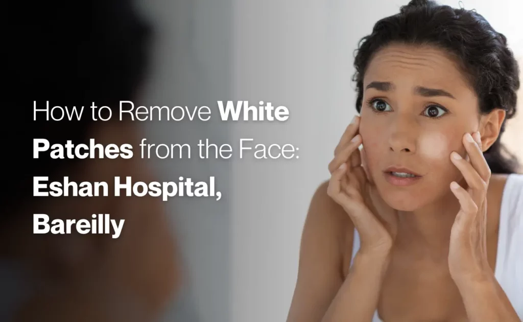 How to remove white patches from face